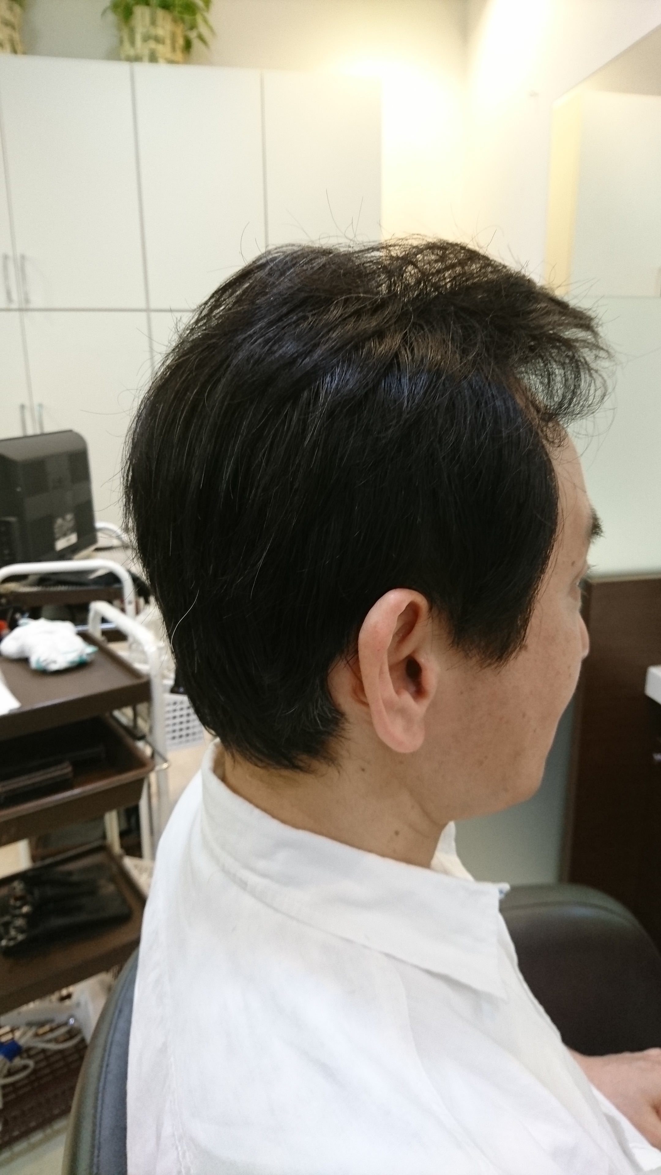 そもそもハゲてきたら坊主にすればいいのでは？？ - 美容師とつくる薄毛専門メンズウィッグ