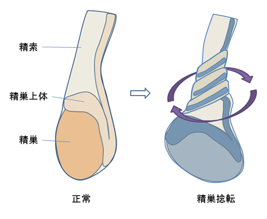 むけない包茎を自分で改善できる方法「むきトレ」とは？ | ネオ形成外科