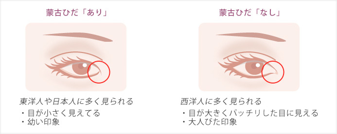 目の形の種類とは？目の形が与える印象を解説！理想の目の形を目指す美容施術も紹介 - WOMクリニック銀座
