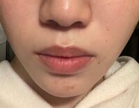 青髭って人から見て気になりますか？自分はコンプレックスなみに青髭- Yahoo!知恵袋