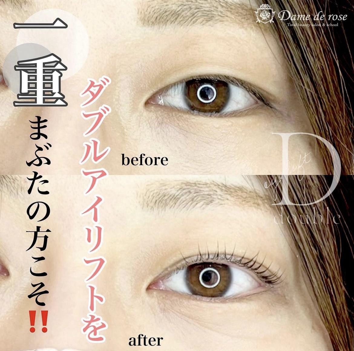 一重は、マツエクで二重になる？ 結論と実証例