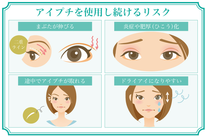 自力で二重になる方法はある？気になる噂と注意点について解説！水の森美容クリニック公式