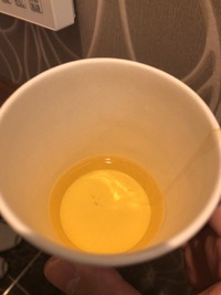 高校生です。尿に少し泡が出て消えないのですが、糖尿病でしょう- Yahoo!知恵袋