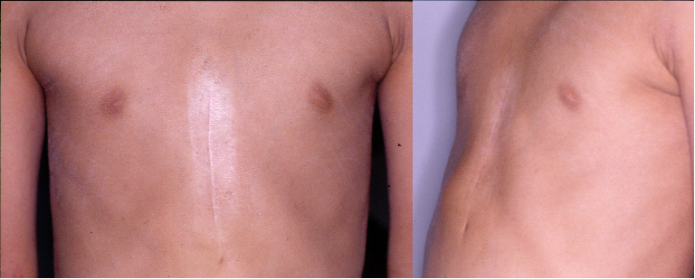 剣状突起の写真素材 - PIXTA