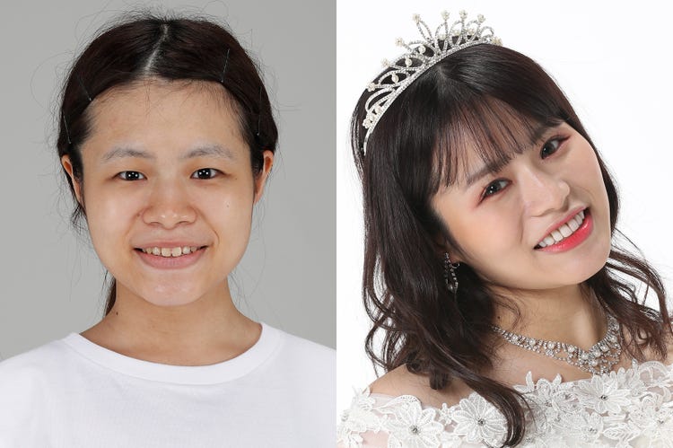 ビューティーコロシアムの怖い話：美の代償〜整形後の苦悩と現実