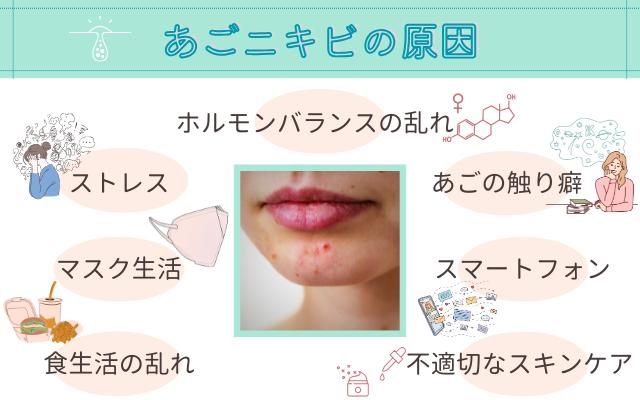 顎の下の大きなできもの、押すと痛みがあります。ニキビ・ニキビ跡の治療の治療への不安 痛み・失敗・副作用