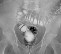 一般撮影検査石川病院