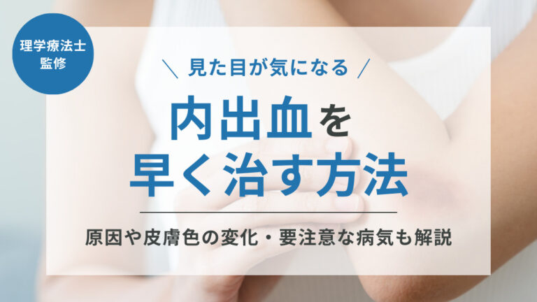 美容整形での内出血の原因や早く跡を消す方法を医師が解説公式コラム美容整形・二重整形なら共立美容外科