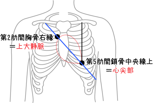 第5回 電極のつけ方と基本波形INFORMA by メディックメディア