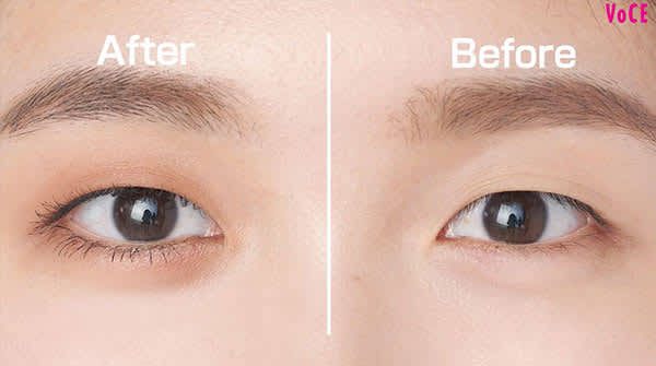 母の日ギフトに。 目が小さくなる“しじみ目”は、 目頭と目尻をそれぞれ外側に引っ張る靭帯が緩んでまぶたの横幅が小さくなった状態。おばあちゃんになると、、 まぶたの中心が突き出して 三角の目に。 「三角目」は目尻側の脂肪と皮膚が下垂した状態です。 技法により