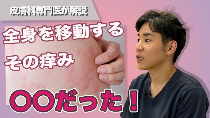 皮膚描画症 を根本から改善したい方 大阪 原因を特定する整体院 医師も推薦する技術とまり木整体院