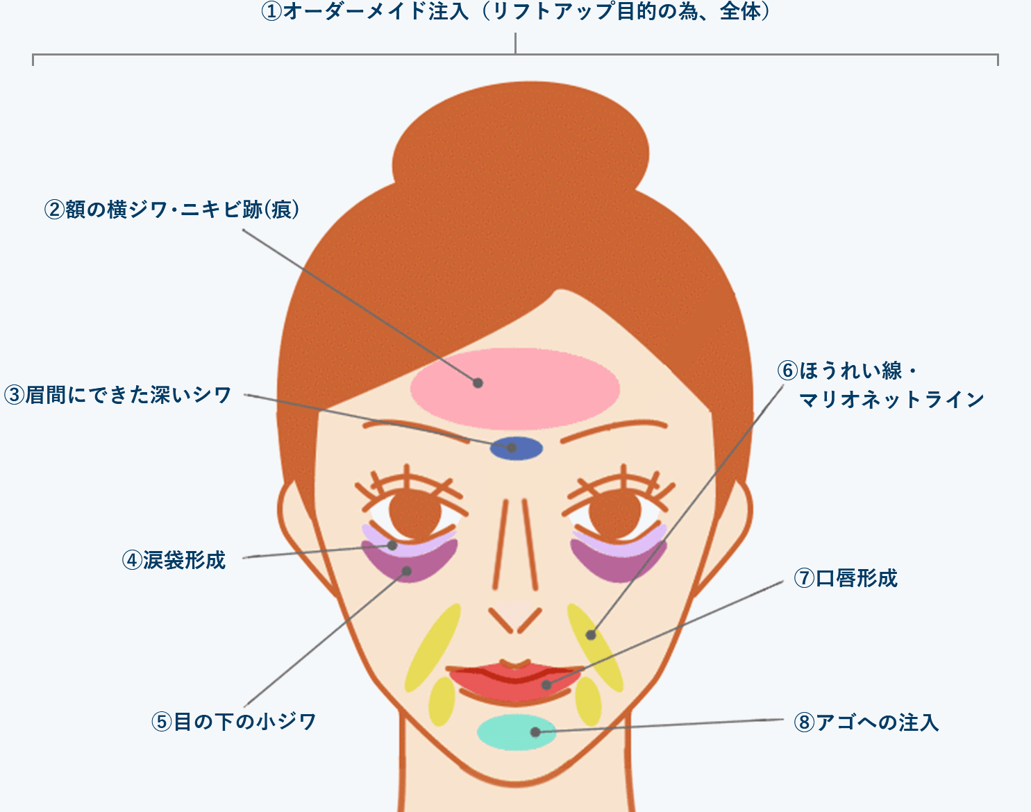 ニキビ占いで簡単に運勢を判断する方法！あなたのハートを開く人相 23- 美・フェイスナビゲータ