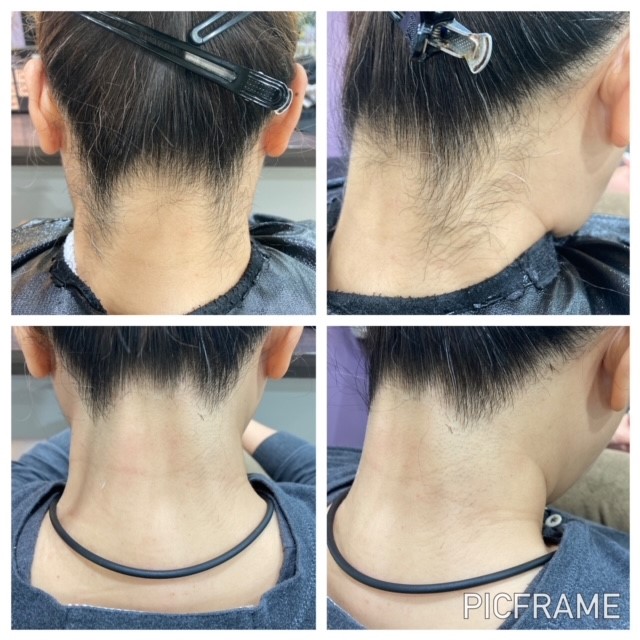 うなじの毛、どうしてる？首回りの襟足・うなじのムダ毛を処理する方法うる肌シェービング