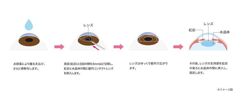 あなたの視力、異常ないですか？新田情報局愛知県知多半島に展開するパチンコ有楽グループ