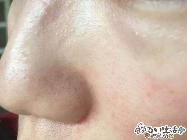 綿棒で毛穴の角栓をドバっと落とす！ワセリン&綿棒の正しい角栓ケア方法ハダメディア by BIHADADO.TOKYO