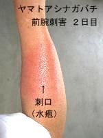 キアシナガバチに刺されたら危険？特徴やその毒性と巣を見つけた場合の対処方を解説 蜂の巣駆除センタ