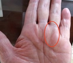 太陽線とは？どこにあるの？手相の太陽線からわかること！意味と見方を徹底解説