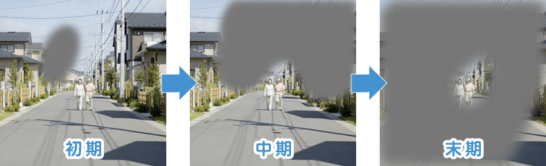 視界にかすみや暗い部分、眼底出血、視野の歪みはありませんか？視野や見え方に異常を感じたら網膜静脈閉塞症網膜ドットコムノバルティスヘルスケアノバルティス ファーマ株式会社