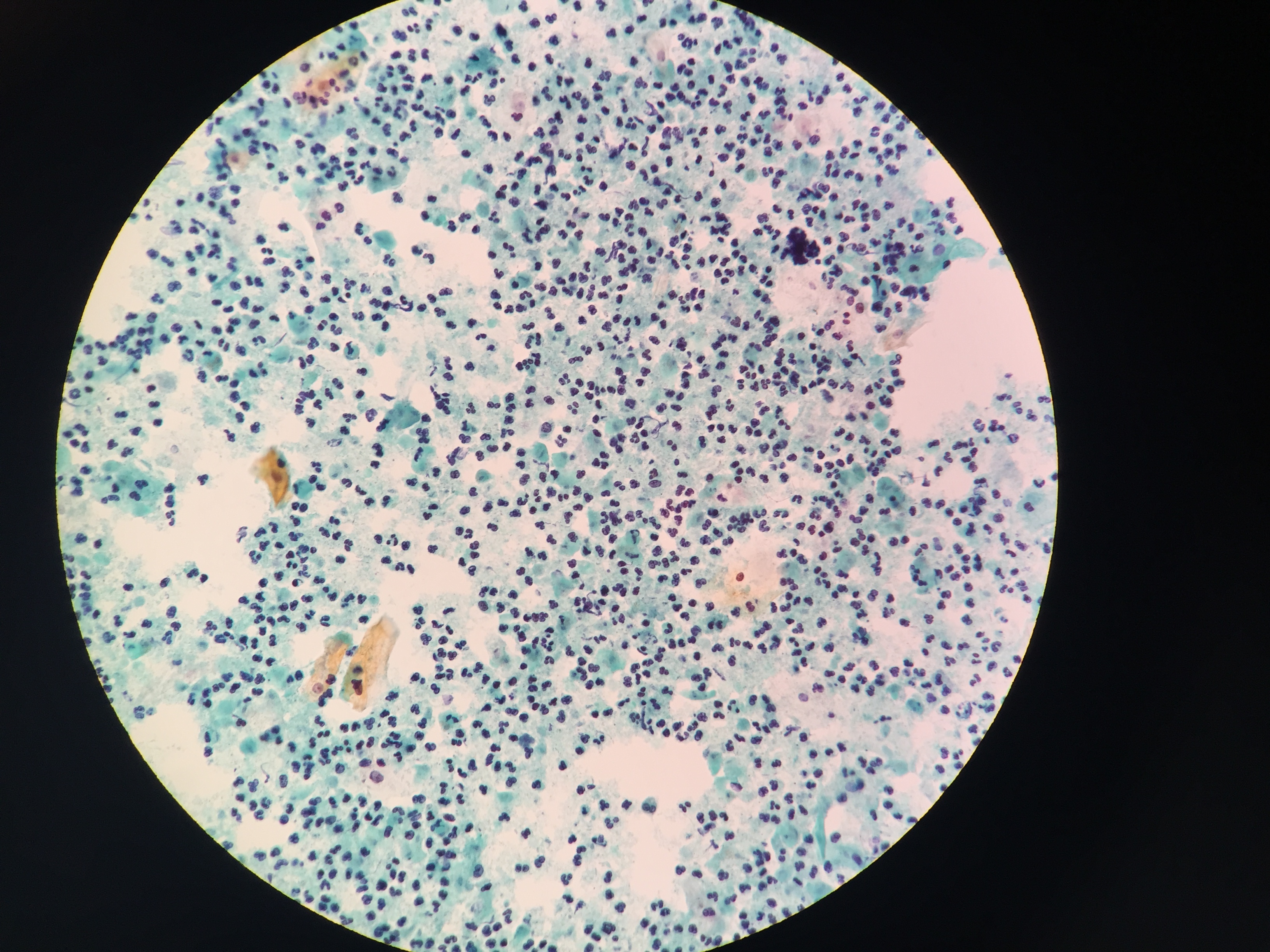 イカ臭い原因！？これが謎の病気、細菌性腟症だ！！医療法人社団 予防会 - コラム・ニュースページ