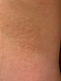 ワキのぶつぶつケア - クィーンメイク２１