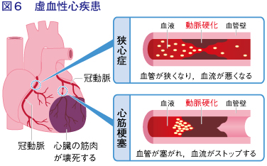 脳の造影剤CT検査結果説明ゆうゆのぼんやり日記