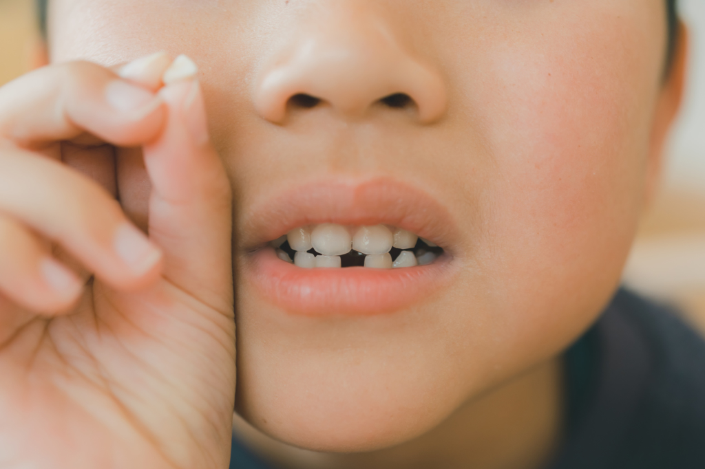 乳歯の根っこが残る「きれいに抜けなかった」ときの対処法 歯科医監修kosodate LIFE 子育てライフ