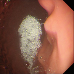 腸のねじれを戻す整体大網白里市の自律神経専門の整体院 仙人堂