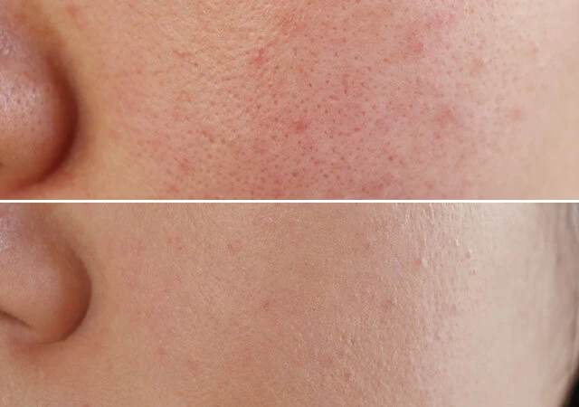 プチプラコスメ ダイソー・セリア・キャンドゥ実際のところ100均コスメってどうなの?!徹底的に調べてみた。マキアオンライン美容雑誌『MAQUIA マキア 』公式ビューティサイト