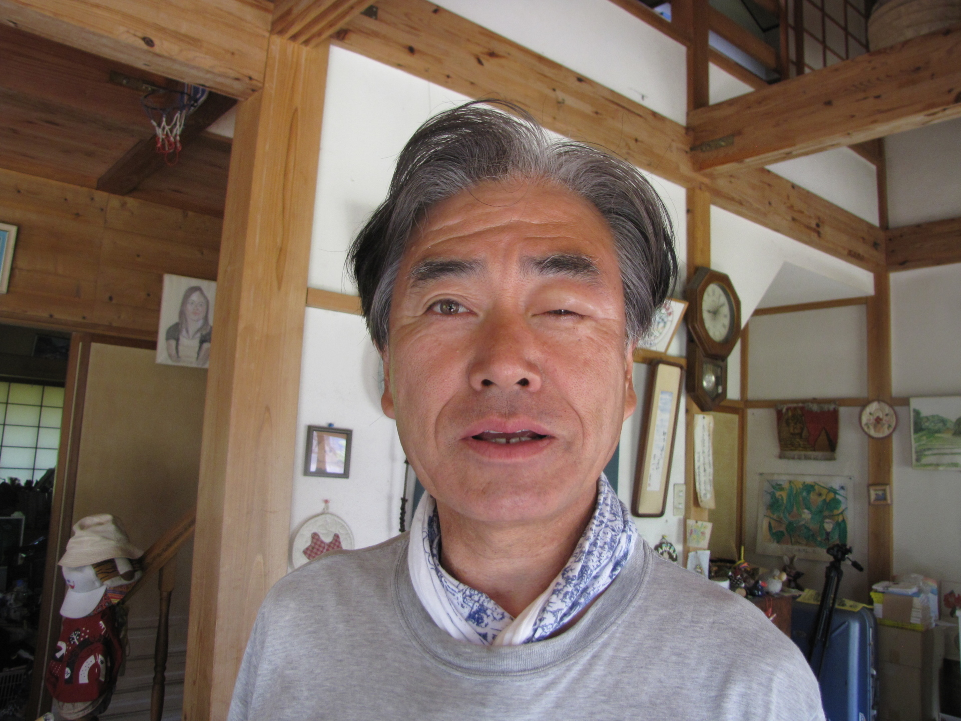 よくある目の症状 まぶたの腫れ・視界が白くぼやける・目がかゆい 中野区の新江古田いわた眼科