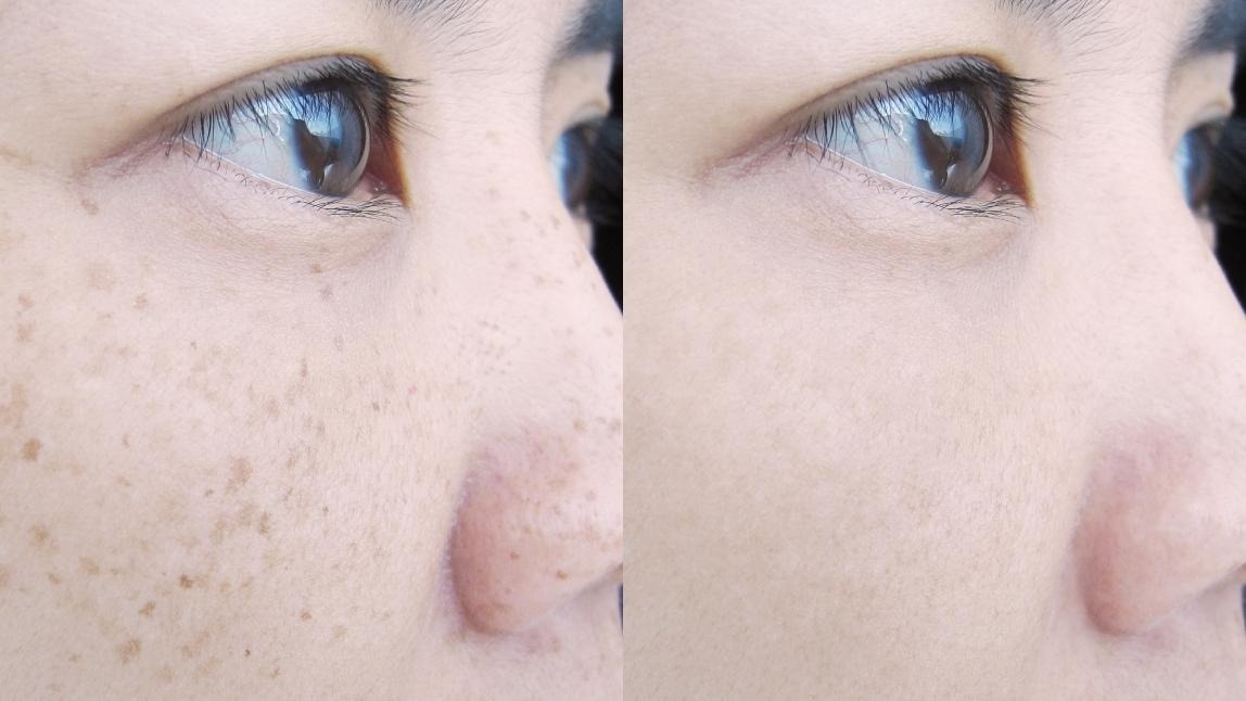 Instagramフォロワー22万人超！美容家田中亜希子さんの「今どき透明感肌」をかなえる！シミ撃退チャレンジ 1画像2 19- レタスクラブ