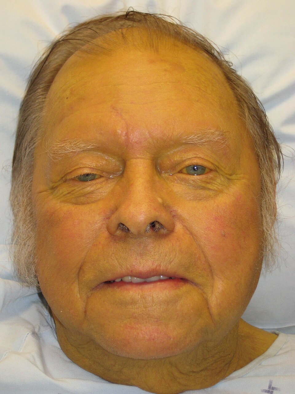 眼睛发黄的病因是什么？ - 病症知识- 轻壹