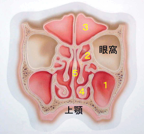 急な片方の鼻づまりは注意~鼻内の腫瘍 - 熊本 くまモンファン 耳鼻咽喉科医の みみ・はな・のど あれこれ