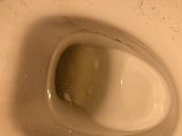 尿が泡立つ 尿の泡 原因・病気・何科・検査・治療神戸市東灘区の「いしむら腎泌尿器科クリニック」