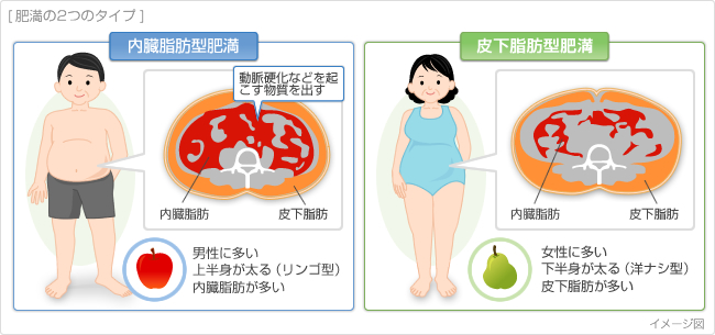 メタボリックシンドローム京都 五条大宮 心臓病 メタボリックシンドローム 睡眠時無呼吸症候群 まつばらクリニック