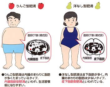 リンゴ型肥満と洋ナシ型肥満浦岡胃腸クリニック