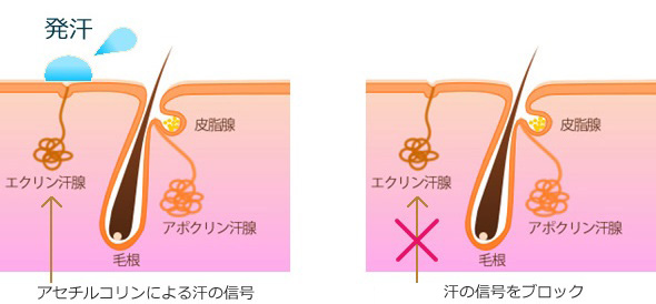 パースピレックスは黒くなる？色素沈着する？原因や対策