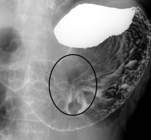 検査結果の見かた公益財団法人 広島県地域保健医療推進機構 HiTS健診プラザ 旧・総合健診センター