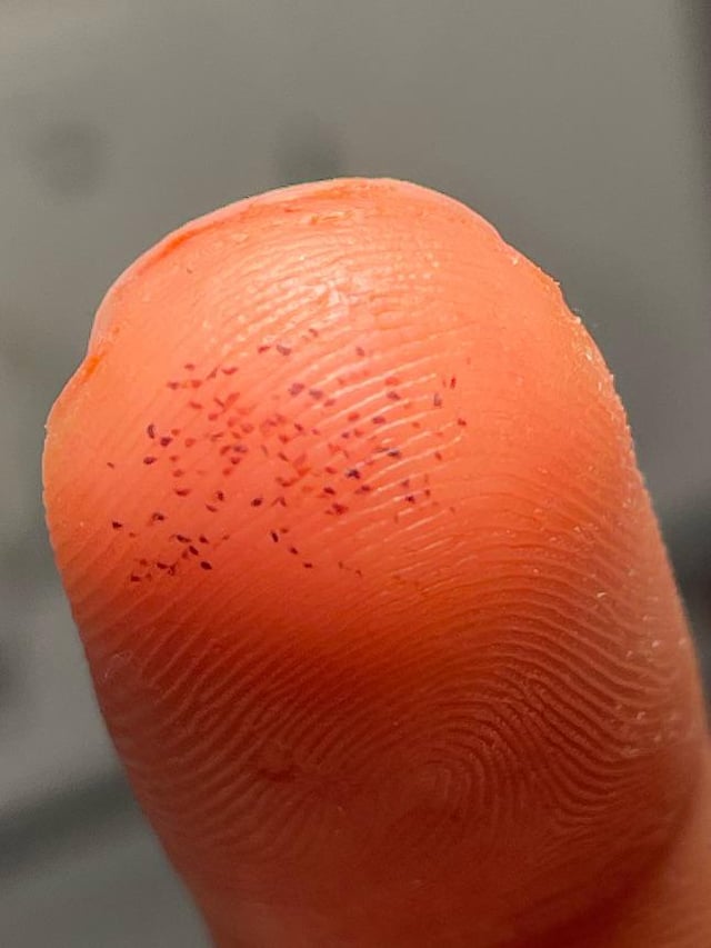 痛い！！ 血豆作る: 連続スリーパット ２