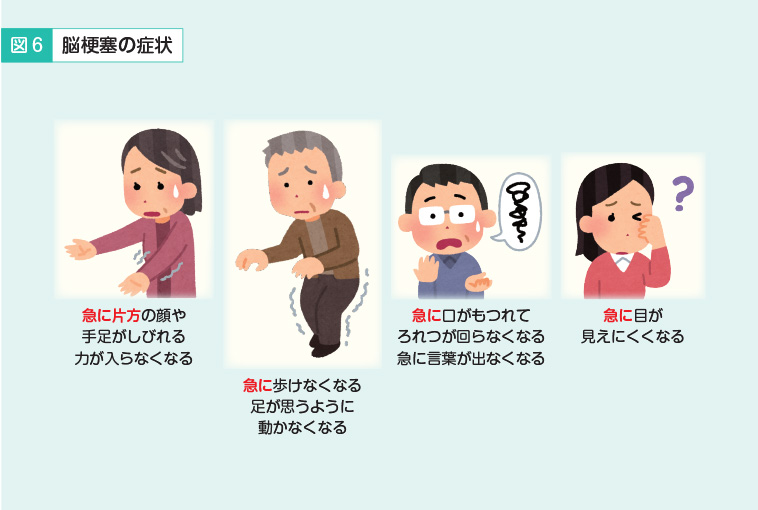 脳卒中」って 何ですか？？脳神経外科北海道医療センタ