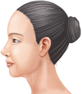 あごと首まわりの脂肪、どう落とす？専門家が教える「7つの対策」ビューティ ×スポーツ『MELOS』