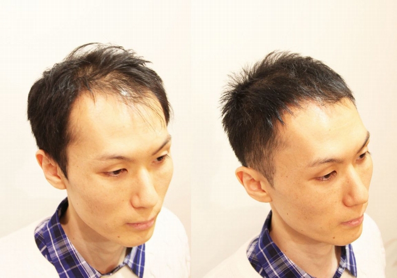 メンズの髪型９選 薄毛が目立たない今日からやろうよ!奈良斑鳩町の美容室「髪」ブログ