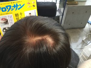 前髪つむじ 割れる前髪を簡単に直す方法！これでもう前髪割れない