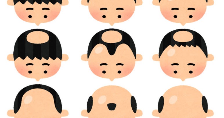 薄毛に悩むイラスト無料イラスト・フリー素材なら「イラストAC」