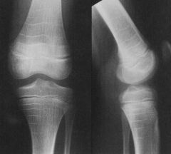 心臓の治療を受けに来た私が、どうして足のレントゲン写真を撮るの？」 – みどり病院神戸市、明石市、循環器、透析