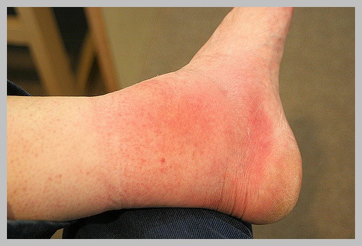 東浦平成病院ひがしうらニュース