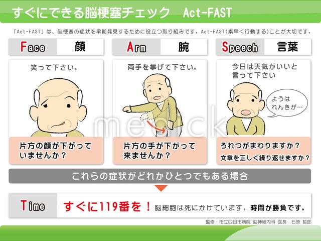 顔面神経麻痺について - liu-method