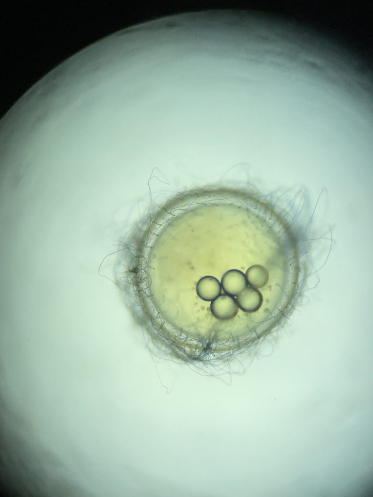 水槽に発生する白いフワフワの正体は？白カビ 水カビ対策方法と白カビを食べる生体アクアリウムを楽しもう