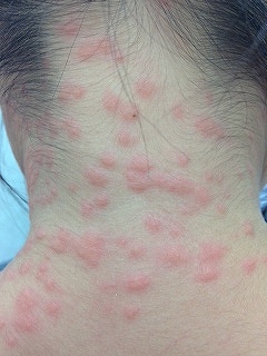 本学学生考案の「三笠うめ酢レシピ集」が大好評！酪農学園大学農食環境学群・獣医学群