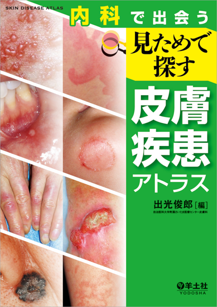 皮膚炎の疾患と症状一覧│アトピー性皮膚炎相談専門 くすりのファイン