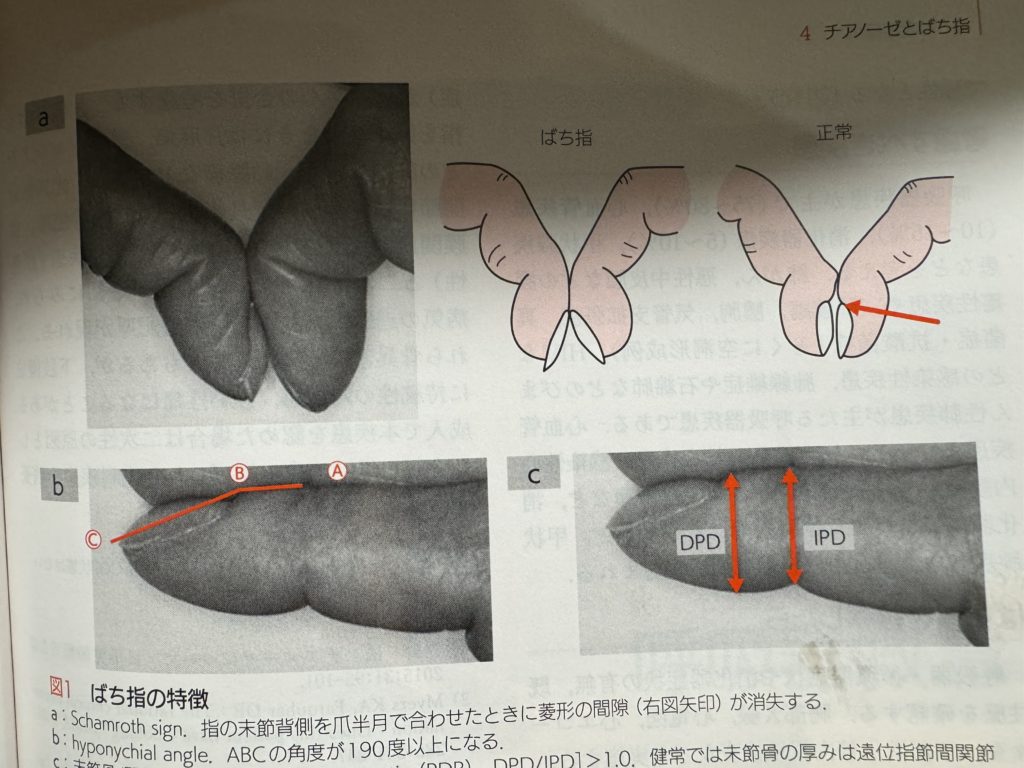 見た目で健康かどうか、わかるの？3ページ目 ：おとなのカラダゼミナール：日経Gooday グッデイ
